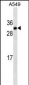 IGF2 Antibody (Ascites)