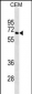 BLNK Antibody (Ascites)