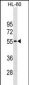 CDKN1C Antibody (Ascites)