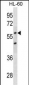 CDKN1C Antibody