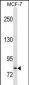 CTNNB1 Antibody (Ascites)