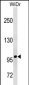 TFRC Antibody