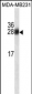 GSTM1 Antibody (Ascites)