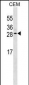 EPO Antibody (Ascites)