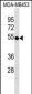 VDR Antibody (Ascites)