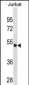 ARSA Antibody (C-term)