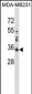 LGALS8 Antibody (C-term)