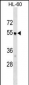 AP3M1 Antibody (C-term)