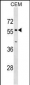 OPTN Antibody (Center)