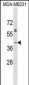 ABO Antibody (N-term)