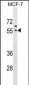 GORASP1 Antibody (Center)