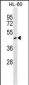 F2R Antibody (N-term)