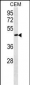 FBLN5 Antibody (C-term)