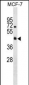 R4RL2 Antibody (C-term)