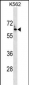 FZD7 Antibody (Center)