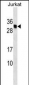 HLA-DMB Antibody (Center)