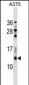 NGFRAP1 Antibody (N-term)
