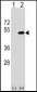 FNTA Antibody (N-term)