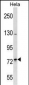 SH3RF2 Antibody (Center)