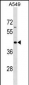 GPR62 Antibody (N-term)