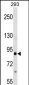 ITGB2 Antibody