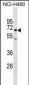 SELE Antibody