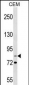 ITGB2 Antibody (N-term)