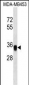 EpCAM Antibody (C-term)