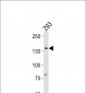 GTF2I Antibody (N-term)