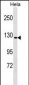 GTF2IRD1 Antibody (N-term)