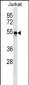WARS Antibody (C-term)