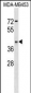 ARSA Antibody (C-term)