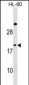 IFNA1 Antibody (C-term)