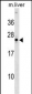 NOG Antibody (Center)