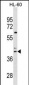 CCR4 Antibody (C-term)