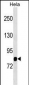 MASP1 Antibody (Center)