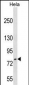 FASTKD3 Antibody (C-term)