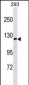 AFF2 Antibody (Center)