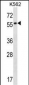 RARB Antibody (Center)