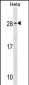 RAB35 Antibody (C-term)