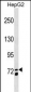 MS4A14 Antibody (C-term)