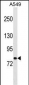 PCDHA1 Antibody (Center)