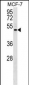 ENPP5 Antibody (C-term)