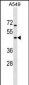 GTPBP5 Antibody (N-term)