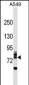 RNF157 Antibody (N-term)