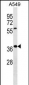 WDR61 Antibody (Center)