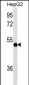 TXNDC5 Antibody (Center)