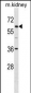 TFE3 Antibody (C-term)