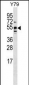 BRUNOL5 Antibody (Center)