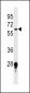 FUT11 Antibody (Center)